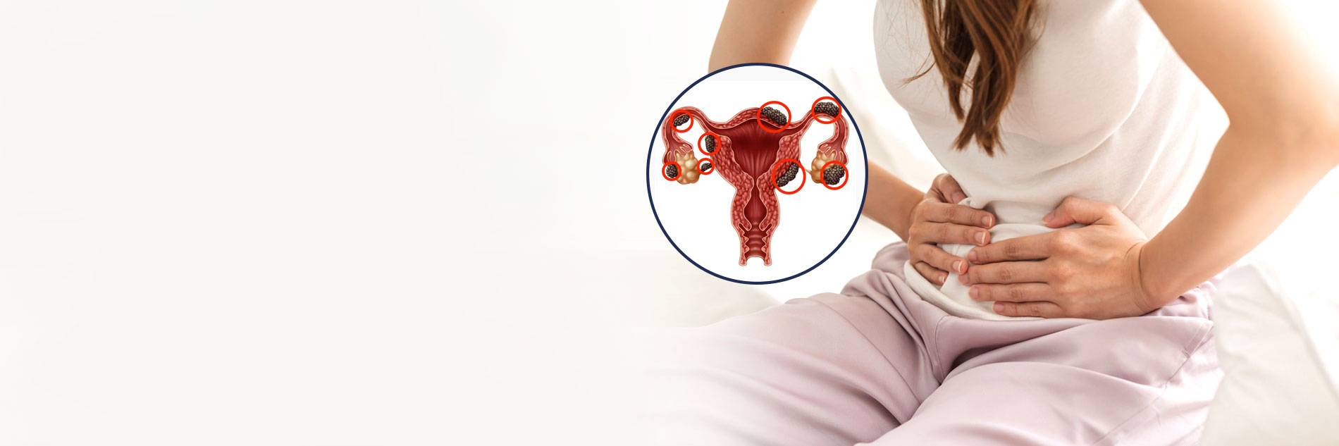 Endometriosis Treatment