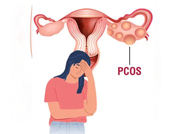 PCOS
