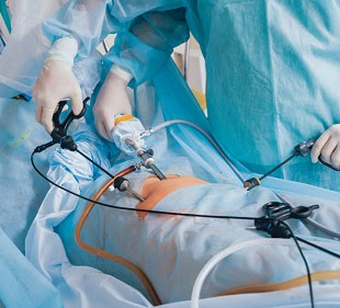 Laparoscopic Surgery